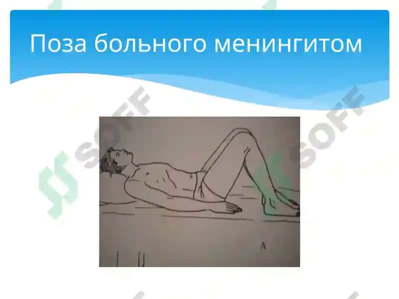 Менингиты Энцефалиты 8