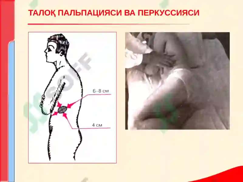 КОН ТИЗИМИ КАСАЛЛИКЛАРИ БИЛАН КАСАЛЛАНГАН БЕМОРЛАРНИ ТЕКШИРИШ 8