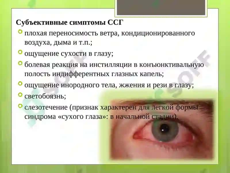 Синдром сухого глаза 8