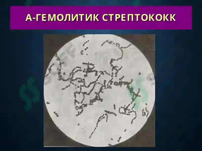 Терининг йирингли касалликлари 8