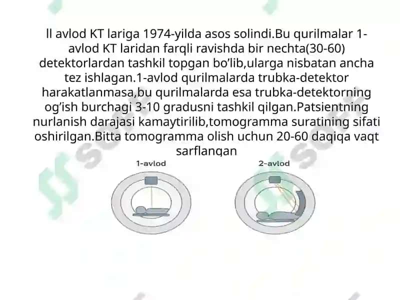 Kompyuter tomografiyasi 8