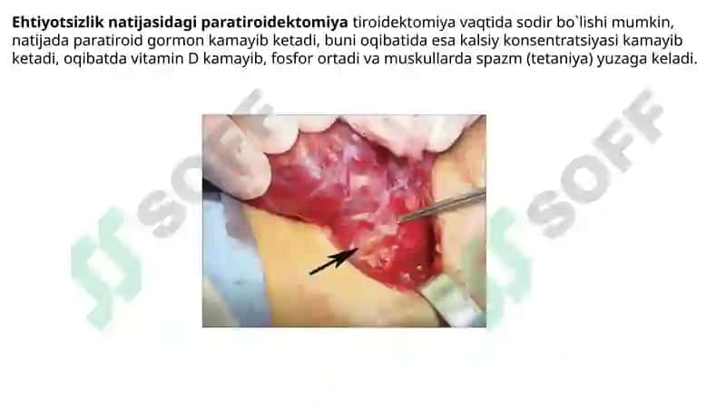 BO’YINNING CHUQUR TUZILMALARI 8