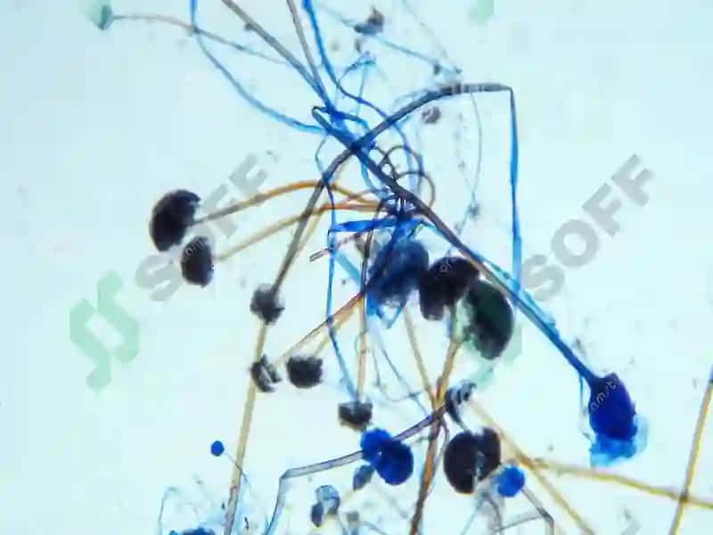 13-MA’RUZA.DON VA DON MAHSULOTLARININGMIKROBIOLOGIYASI 8