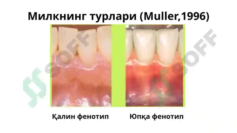 Пародонтонтология 8