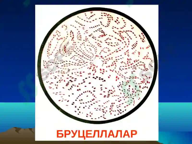 Бруцеллез 8
