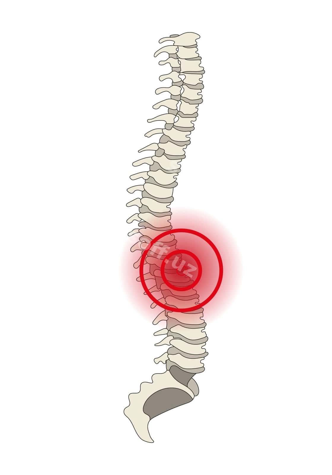 Orqa miya og'rig'i vektori | Spine pain back vector 1