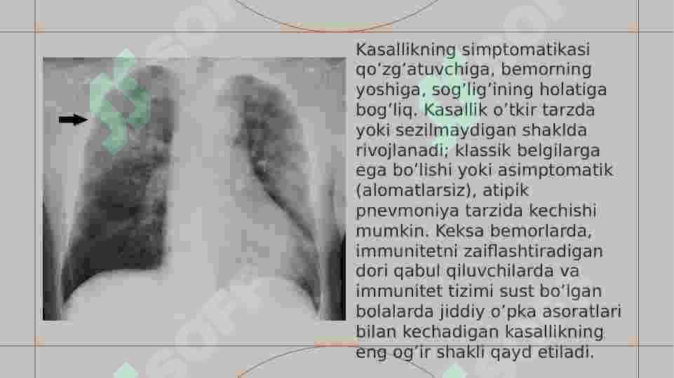 ZOTILJAM kasalligi tasnifi, etiologiyasi 6