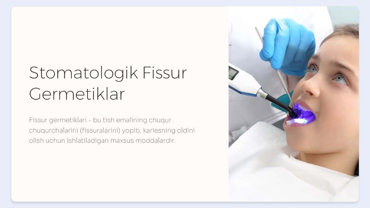 Fissur germetiklar. Qo‘llash texnikasi.