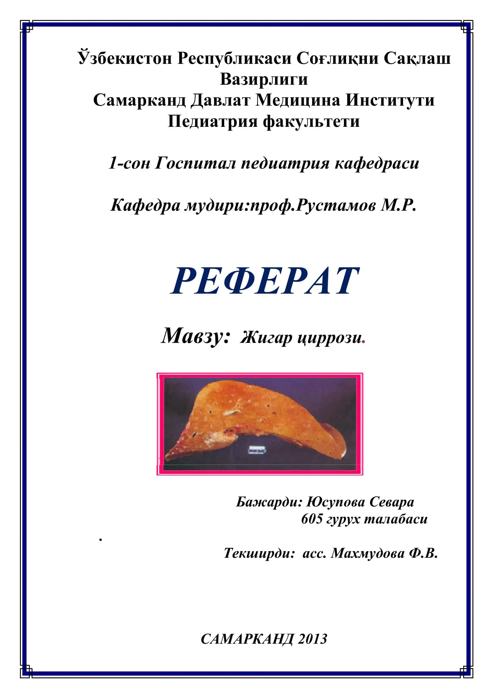 Жигар циррози
