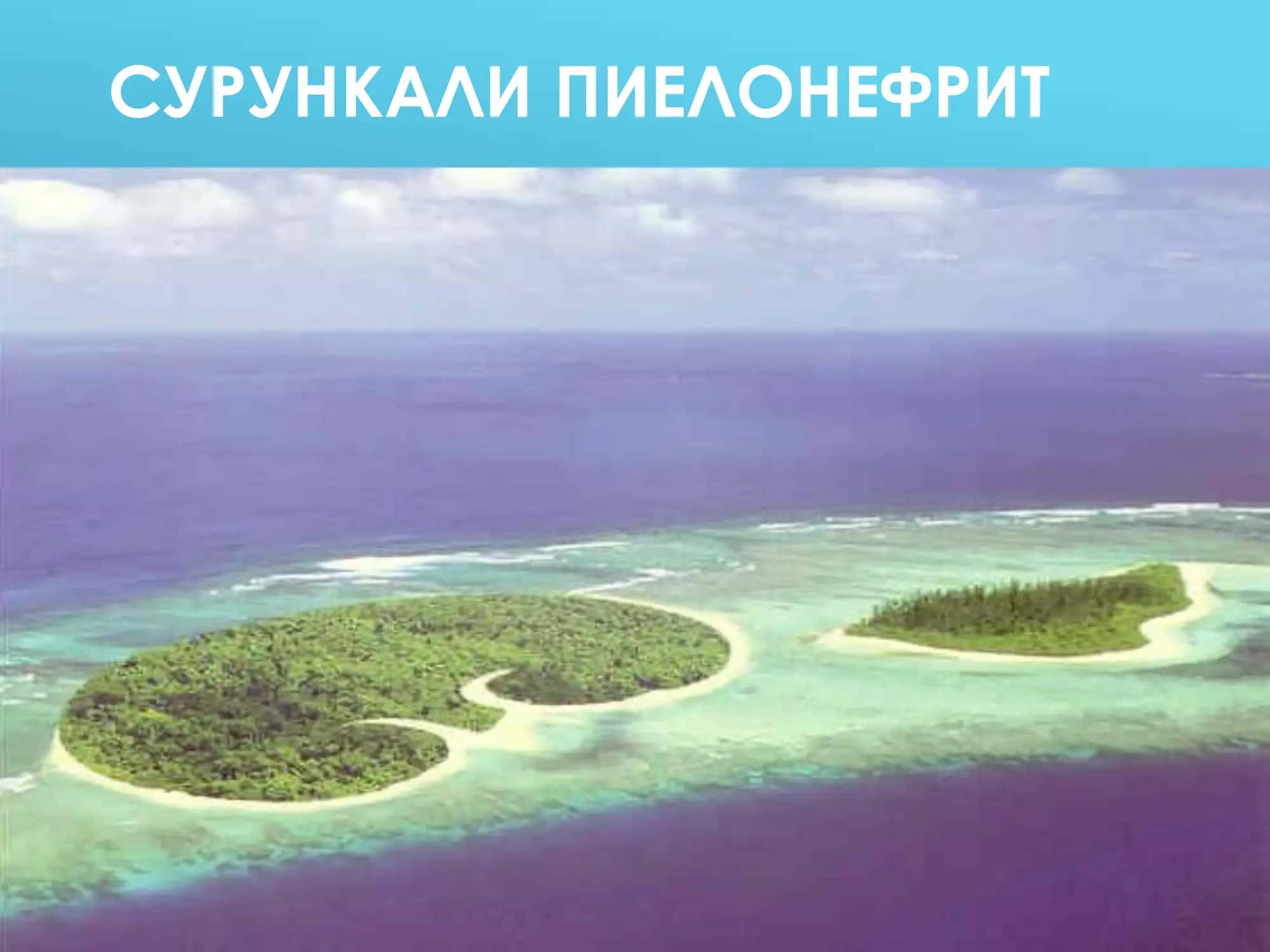 СУРУНКАЛИ ПИЕЛОНЕФРИТ