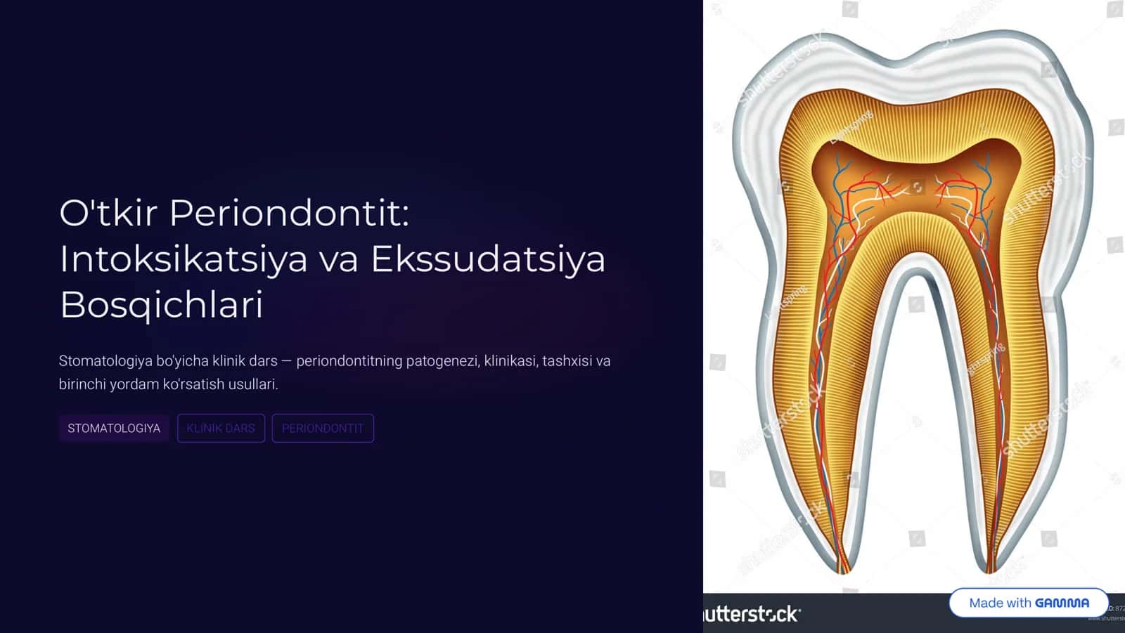 Otkir periodontit