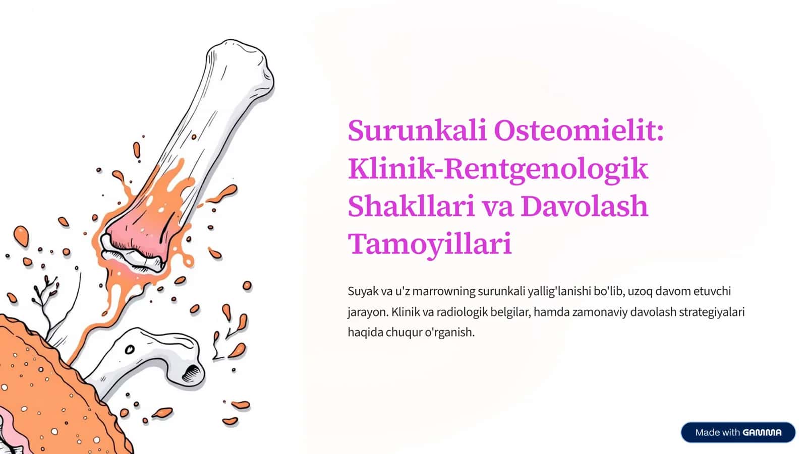 Surunkali Osteomielit: Klinik-Rentgenologik Shakllari va Davolash Tamoyillari