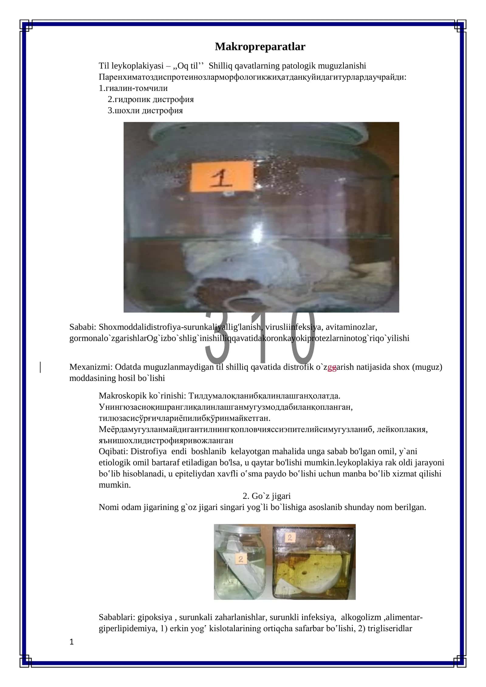 Patanatomiya makropreparatlar