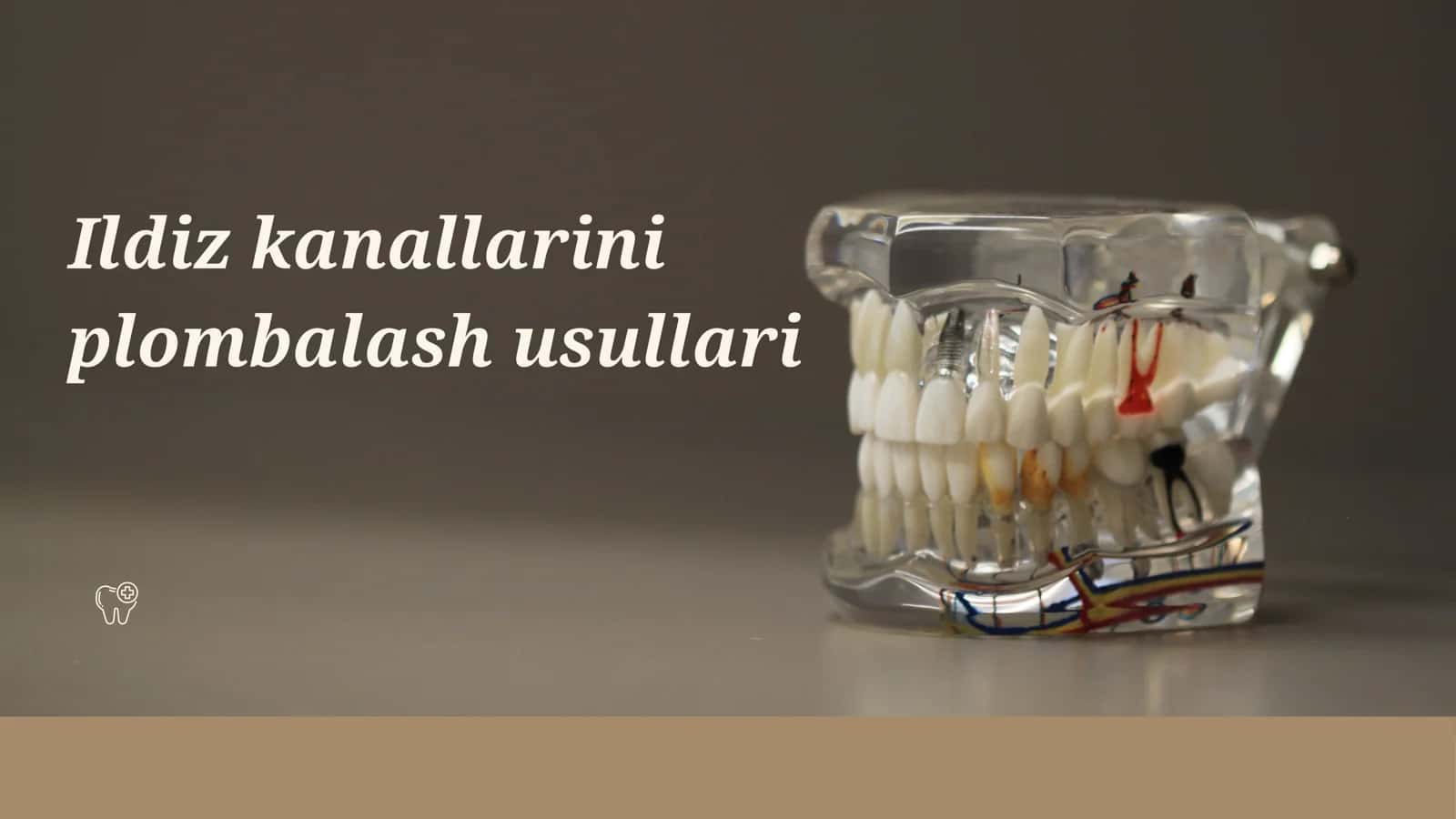 Ildiz kanallarini plombalash usullari
