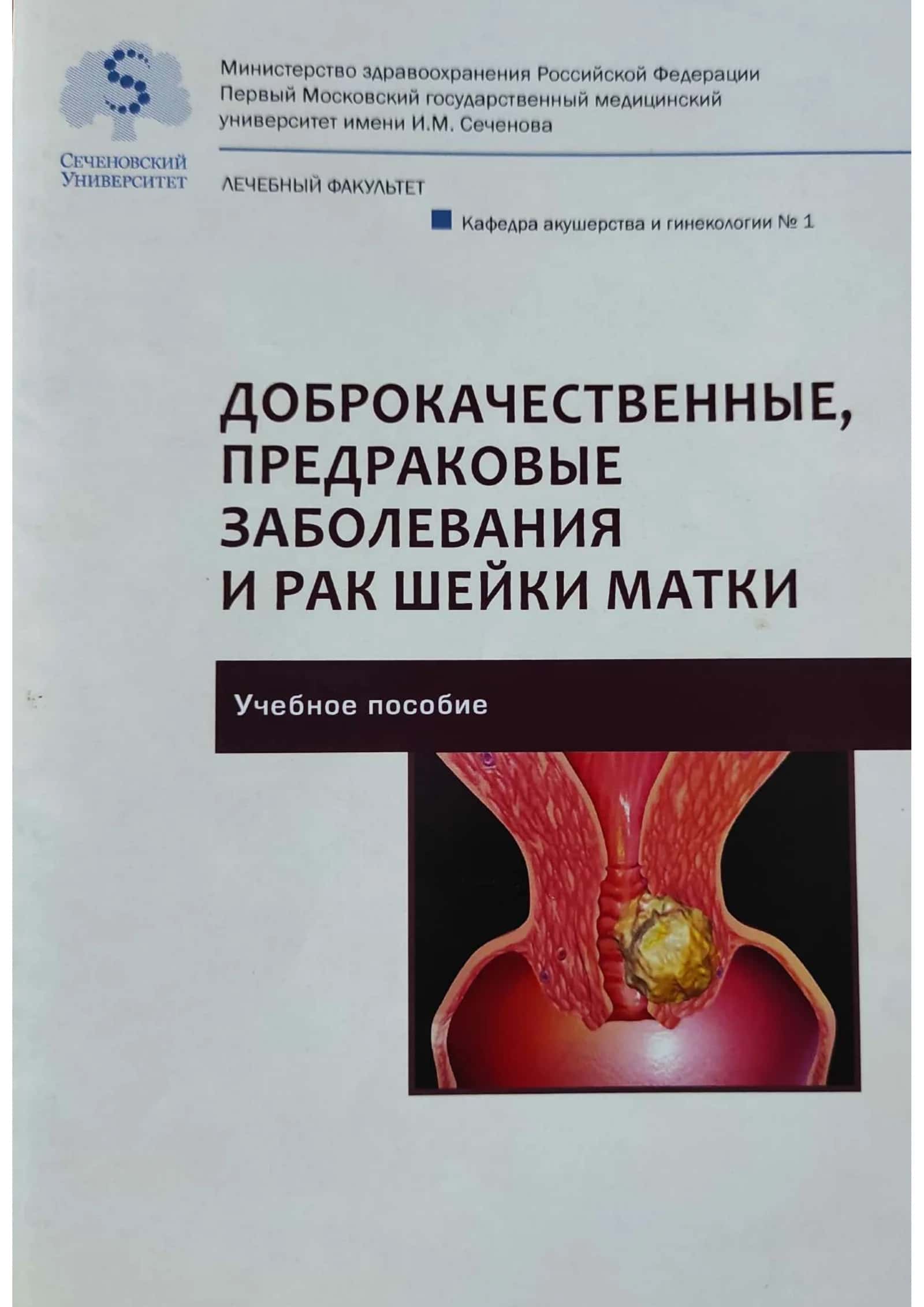Доброкачественные, предраковые заболевания и рак шейки матки