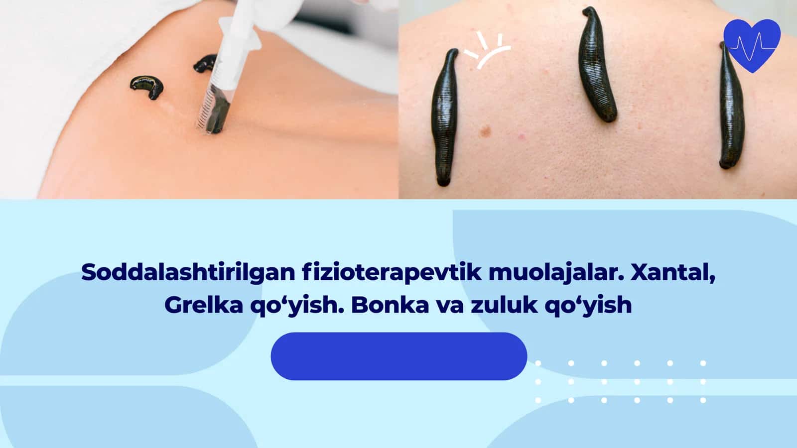 Fizioterapevtik muolajalar