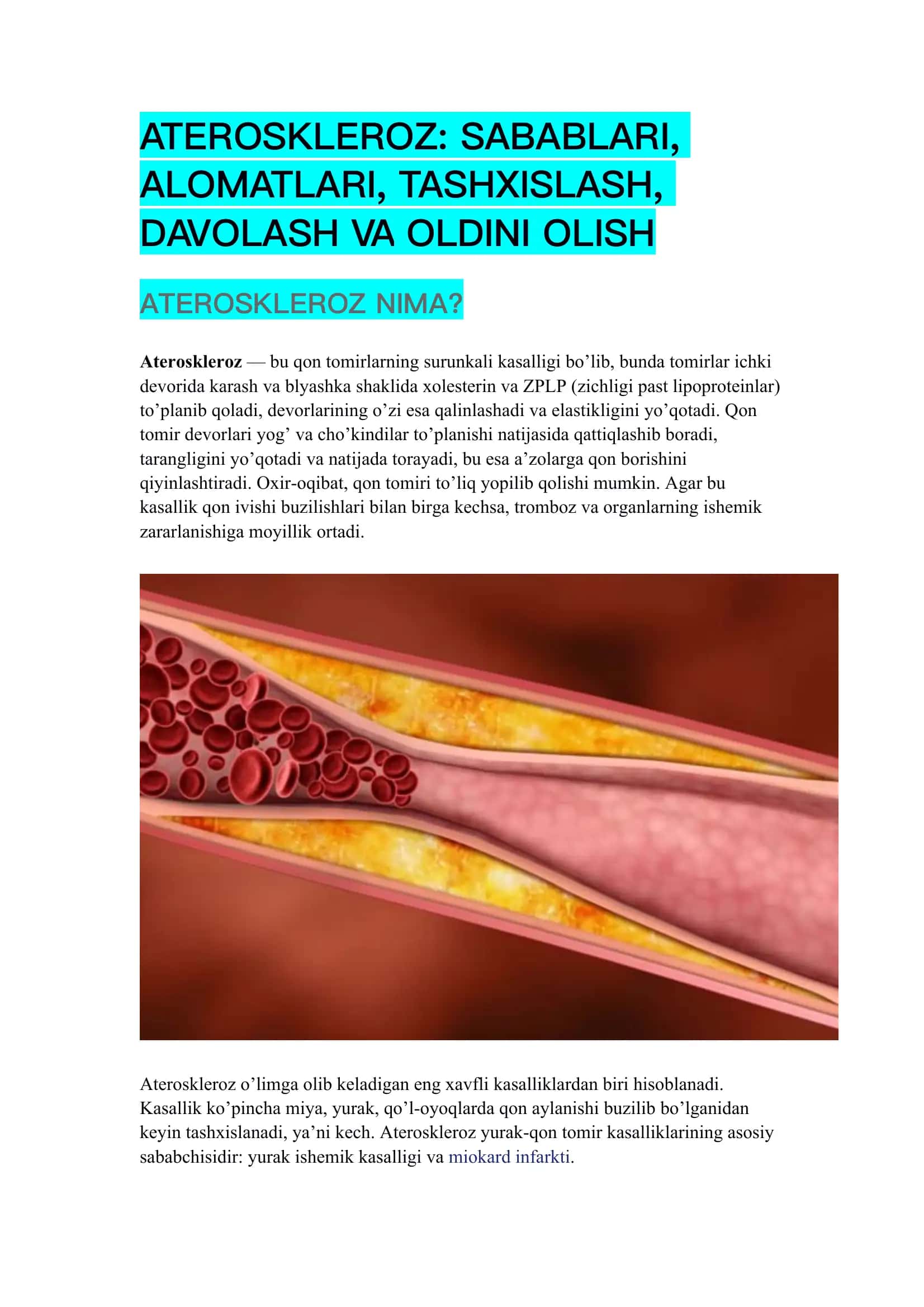 Ateroskleroz: sabablari, alomatlari, tashxislash, davolash va oldini olish