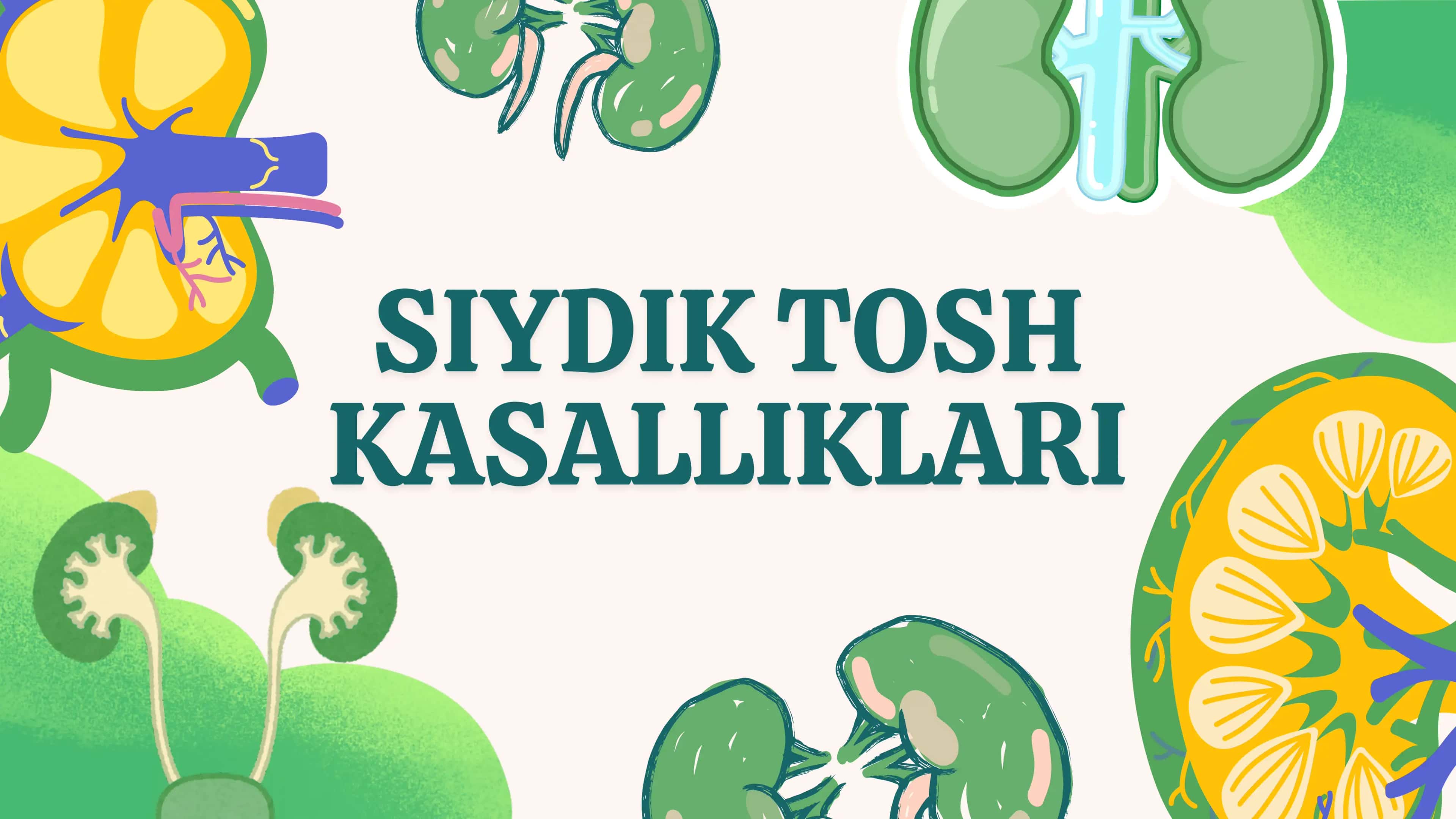 SIYDIK TOSH KASALLIKLARI