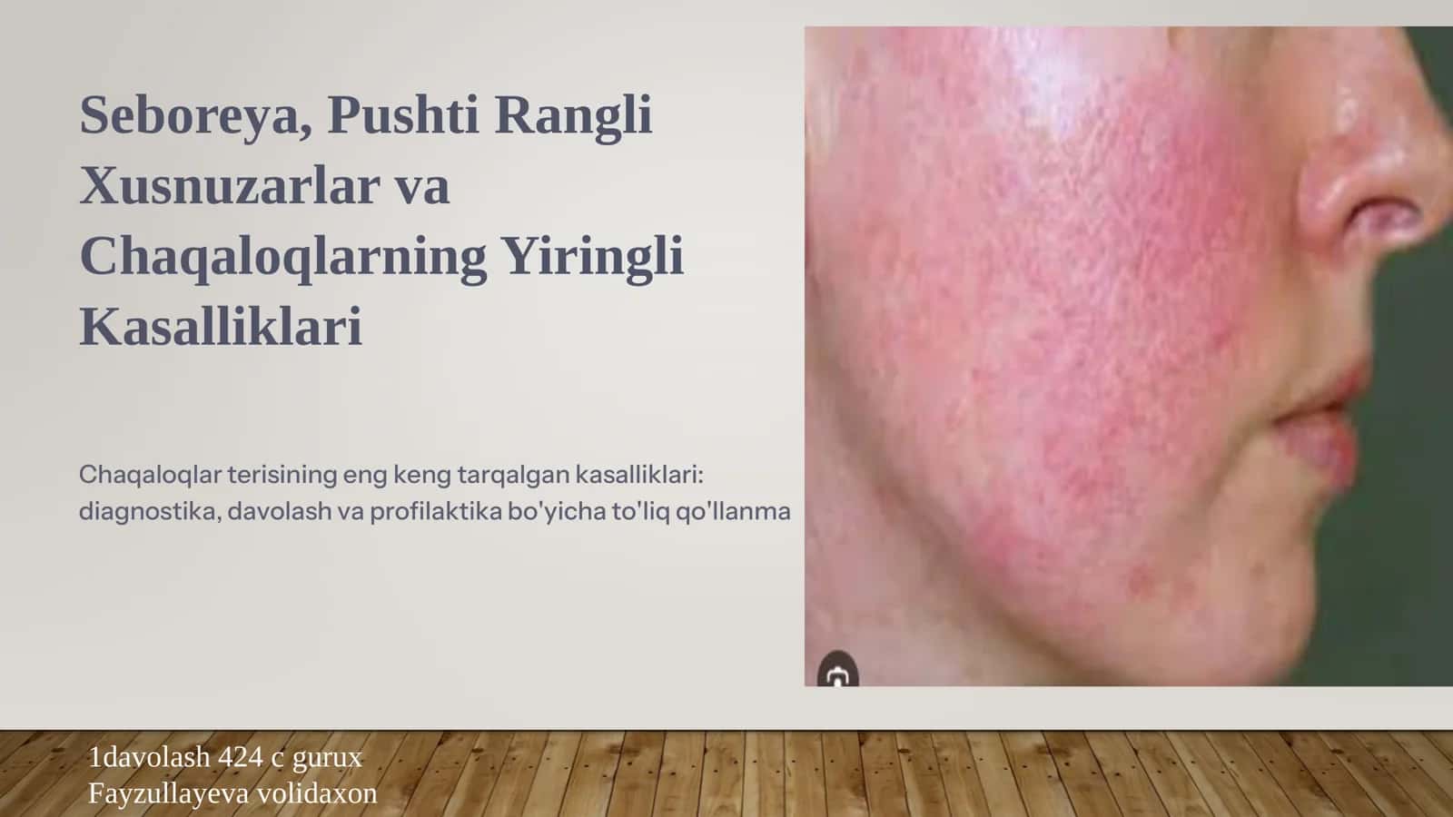 Seboreya, Pushti Rangli Xusnuzarlar va Chaqaloqlarning Yiringli Kasalliklari