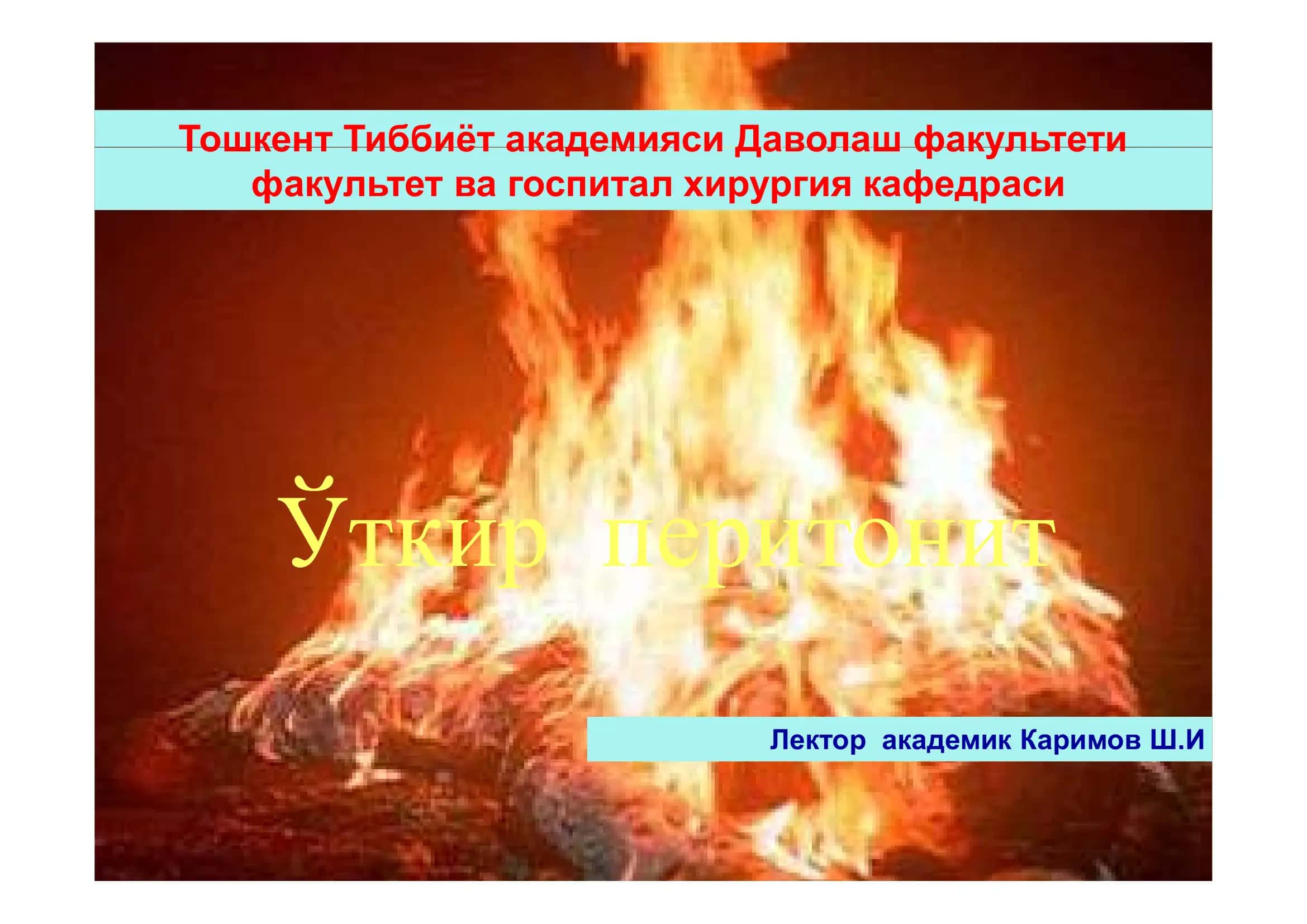 Ўткир перитонит