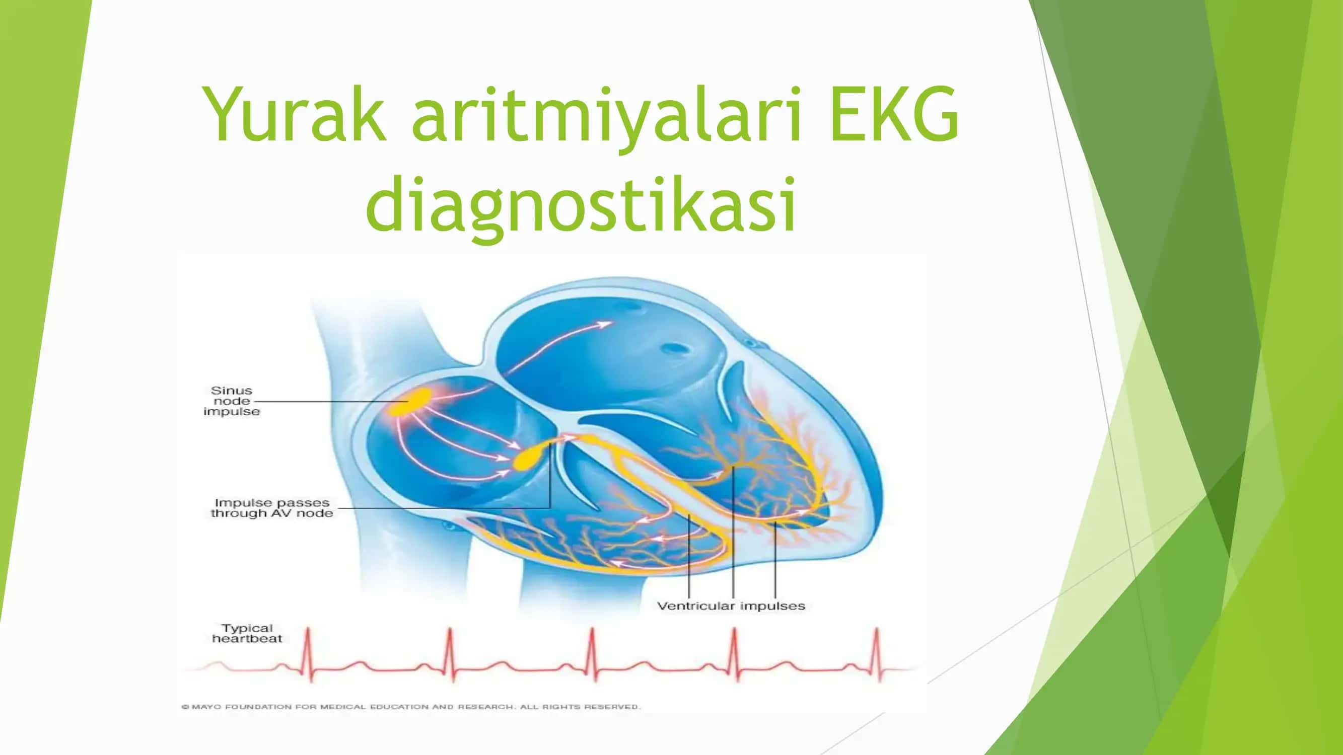 Yurak aritmiyalari EKG diagnostikasi