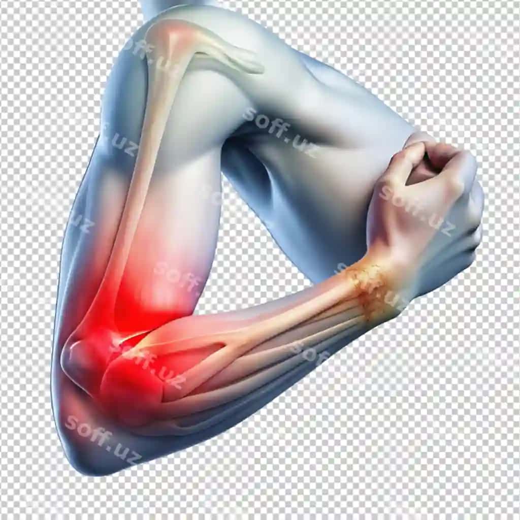Bilek og'riq oq fonda | Elbow pain white background