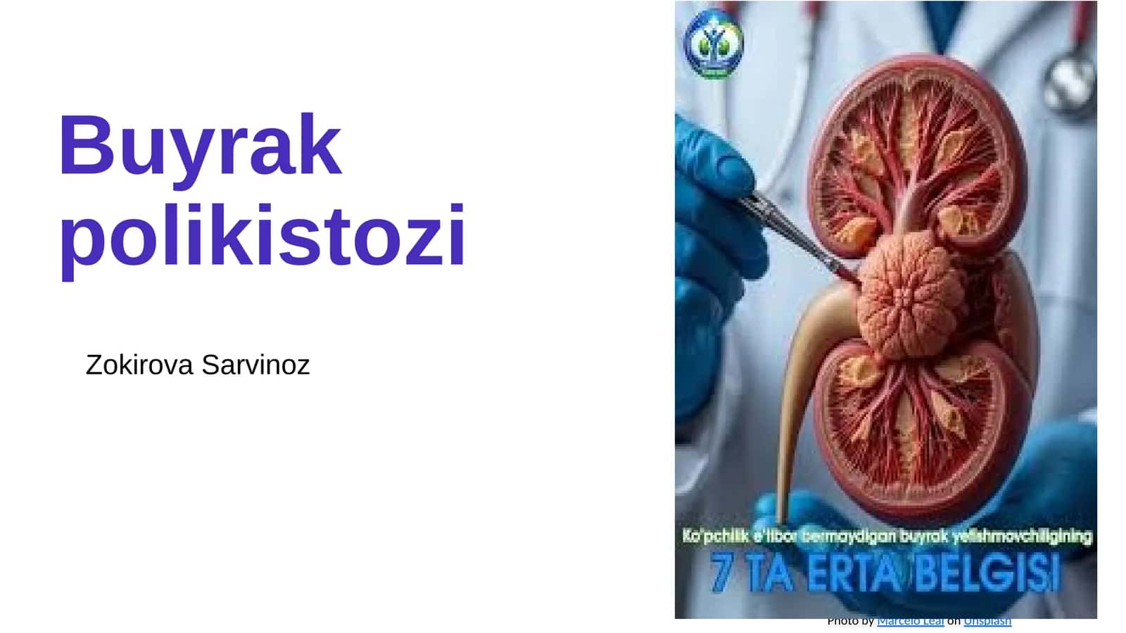 Buyrak polikistozi
