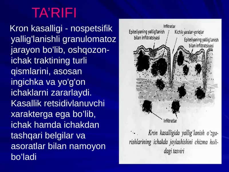 Kronkasalligi-nospetsifikyallig'lanishlig