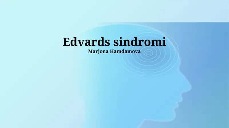 Edwards sindromi