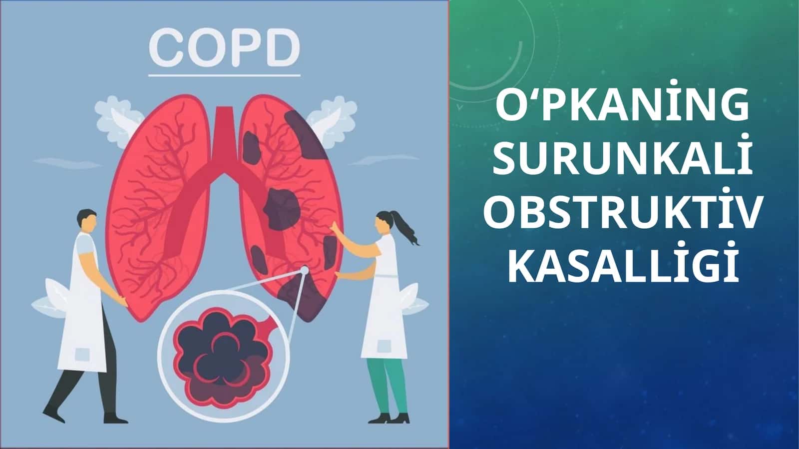 O‘pkaning surunkali obstruktiv kasalligi