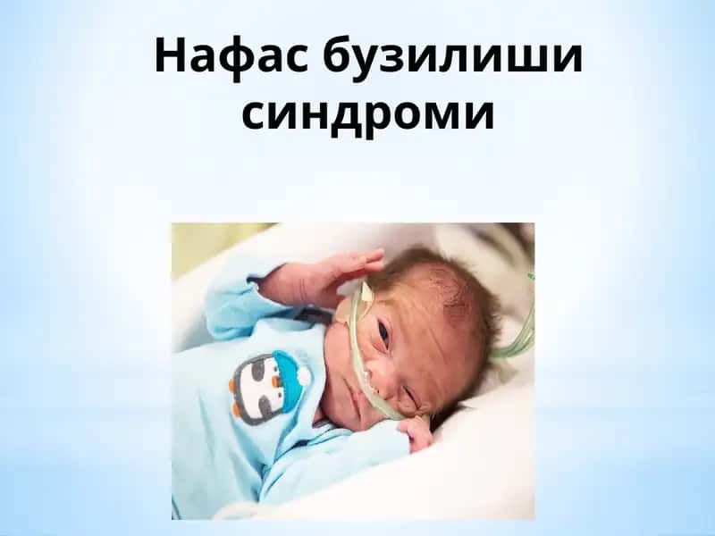 Нафас бузилиши синдроми