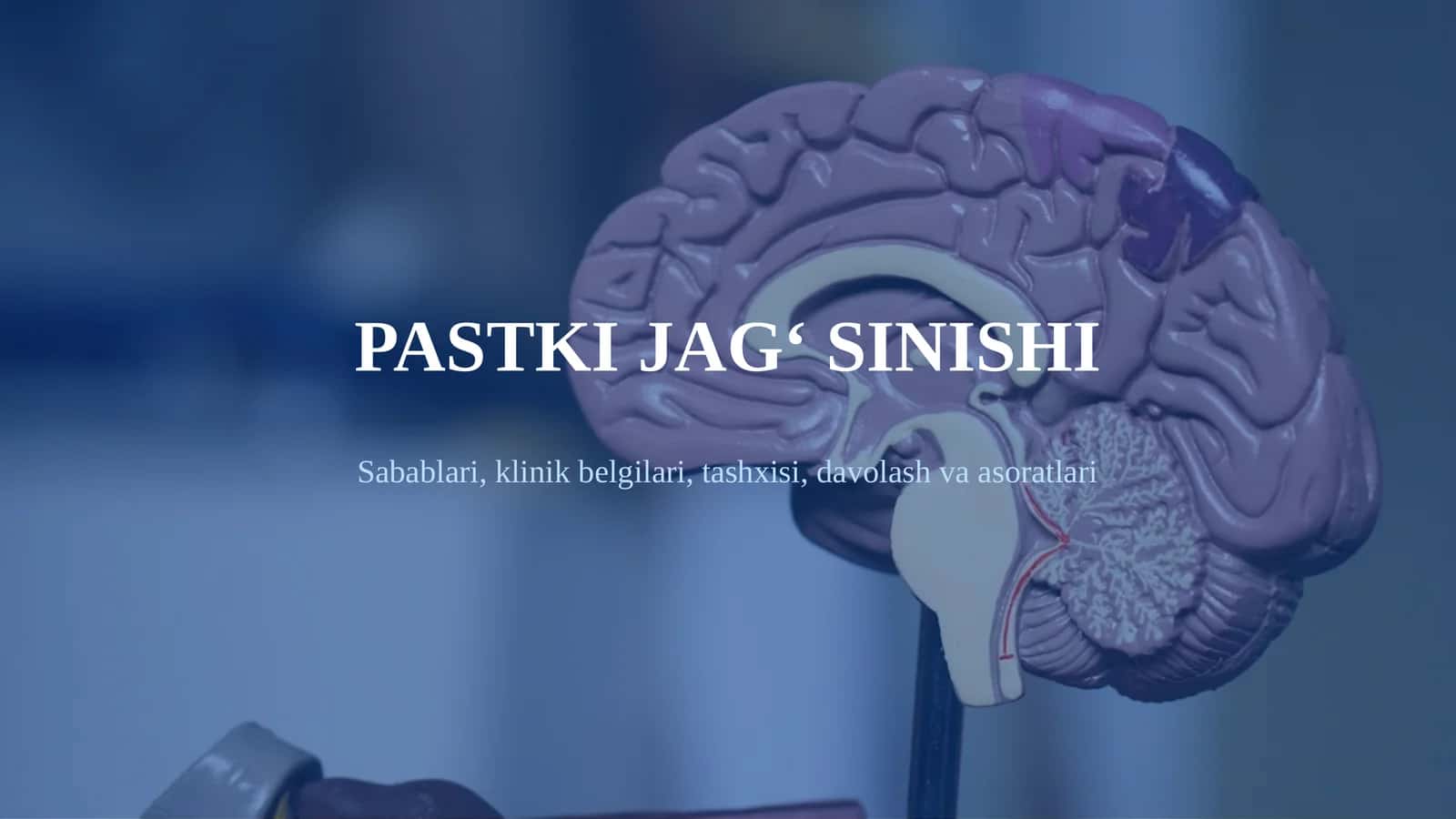 PASTKI JAG‘ SINISHI Sabablari, klinik belgilari, tashxisi, davolash va asoratlari. Pastki jag‘ sinishi haqida umumiy tushuncha