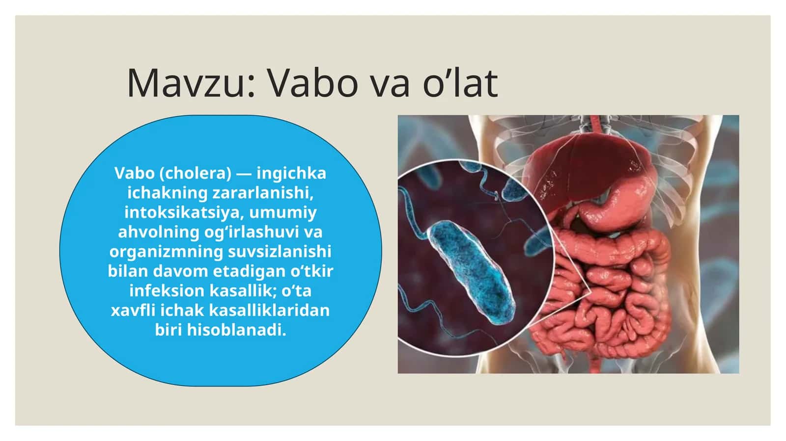Vabo (cholera)