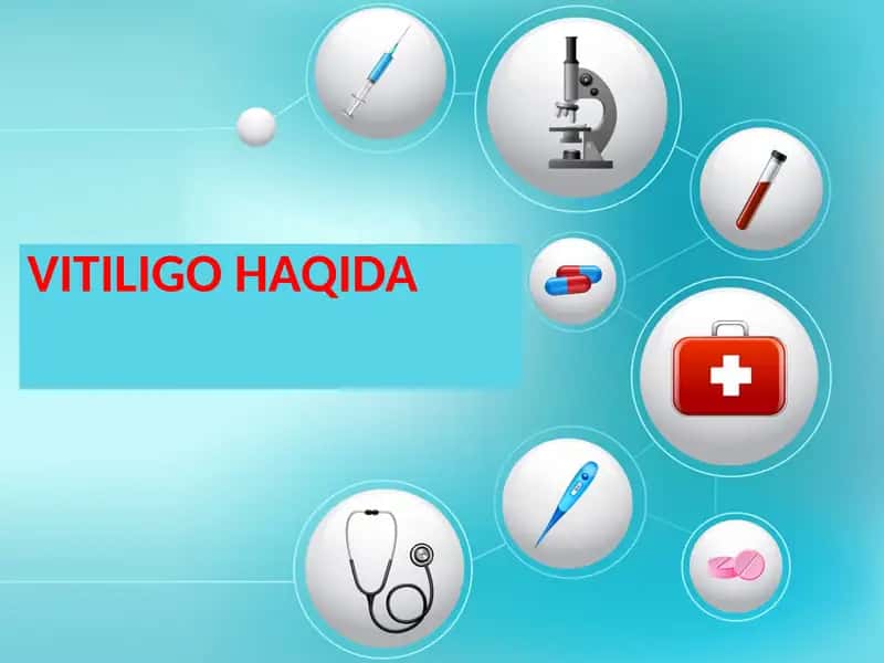 VITILIGO HAQIDA