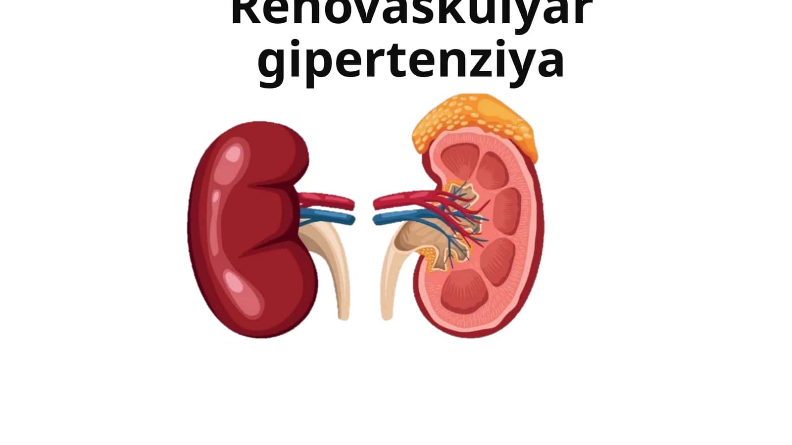 Renovaskulyar gipertenziya