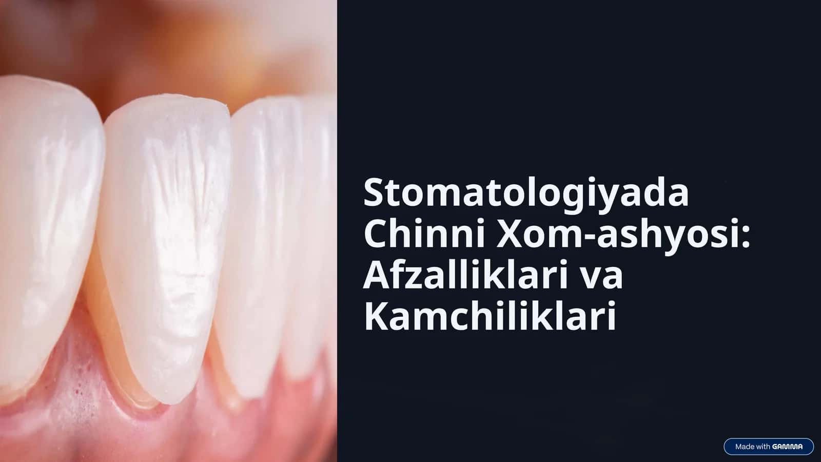 Stomatologiyada Chinni Xom-ashyosi: Afzalliklari va Kamchiliklari