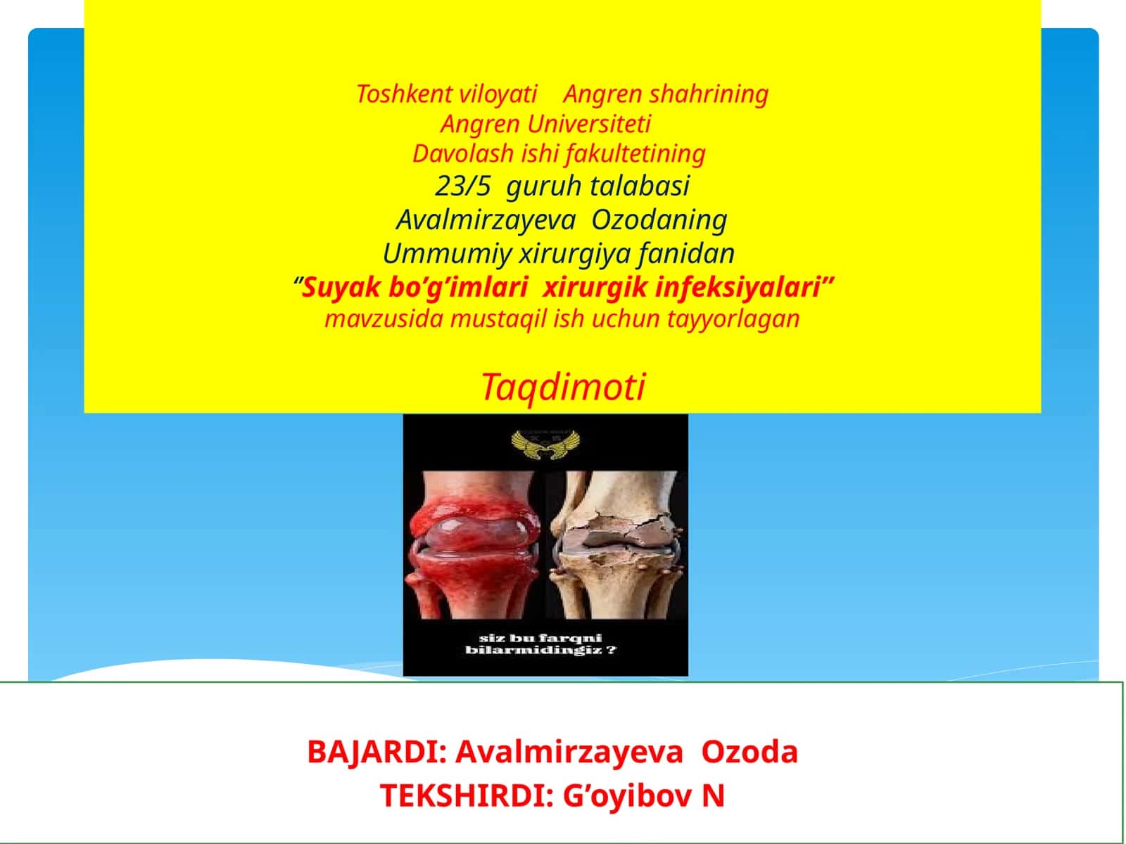 Suyakbo’g’imlarixirurgikinfeksiyalari