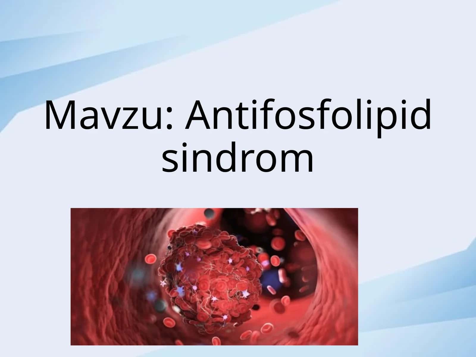 Antifosfolipid sindrom