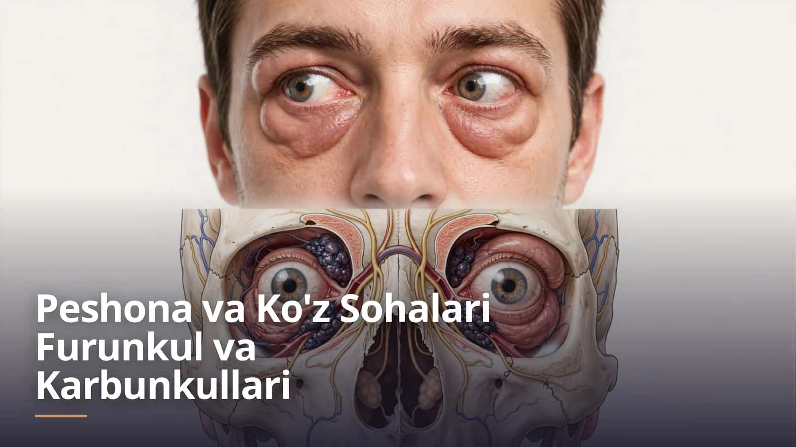 Peshona va Ko'z Sohalari Furunkul va Karbunkullari