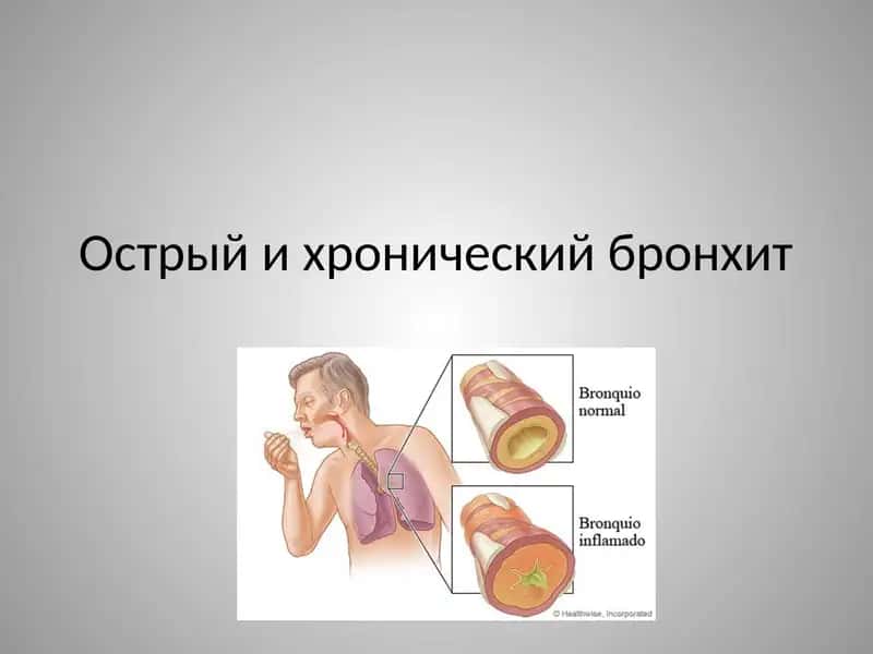 Острый и хронический бронхит