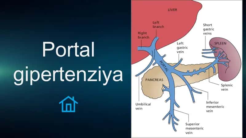 Portal gipertenziya