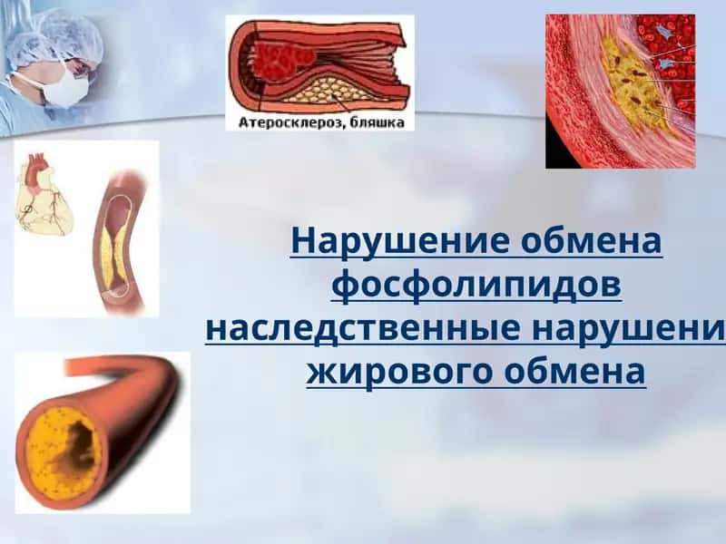 Нарушение обмена фосфолипидов наследственные нарушение жирового обмена