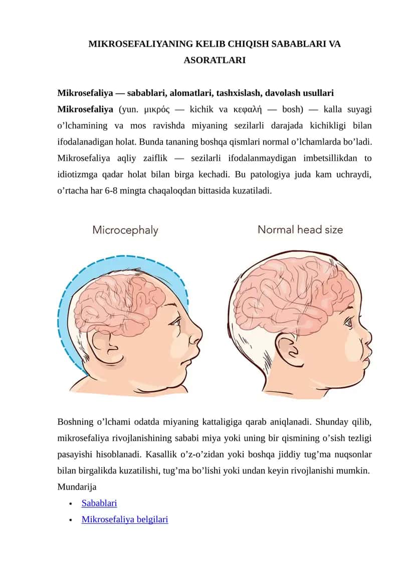 Mikrosefaliyaning Kelib Chiqish Sabablari va Asoratlari