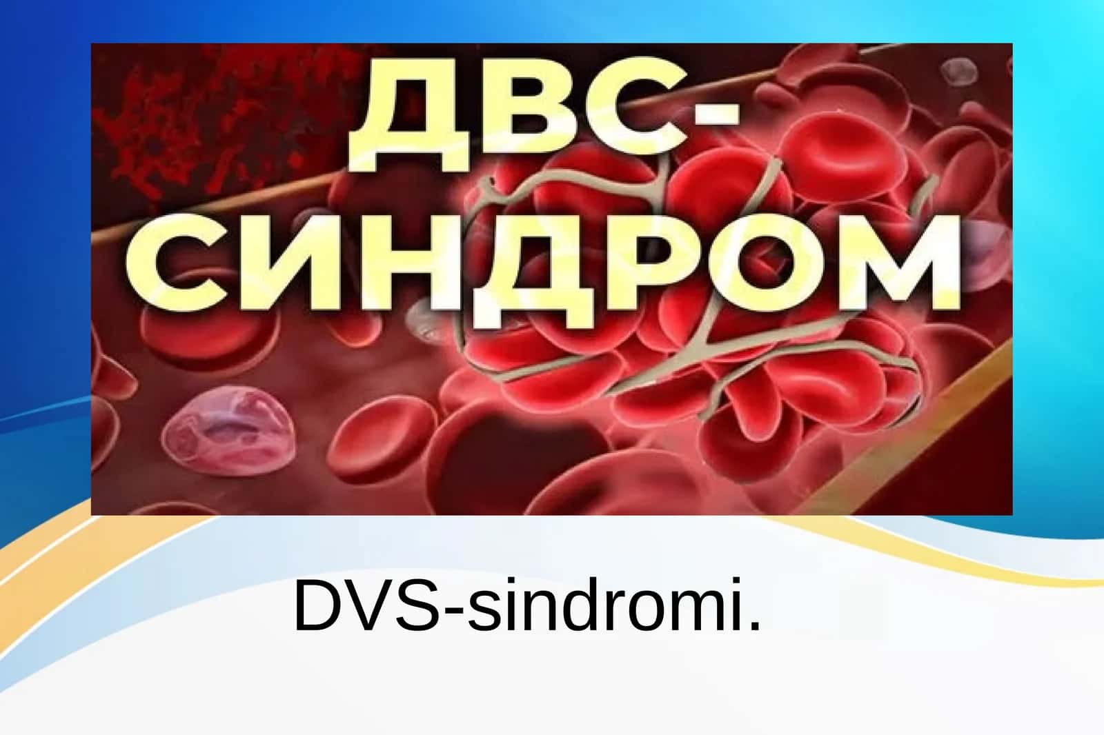 Tromboz, DVS-sindromi, Emboliya patalogik anatomiya.