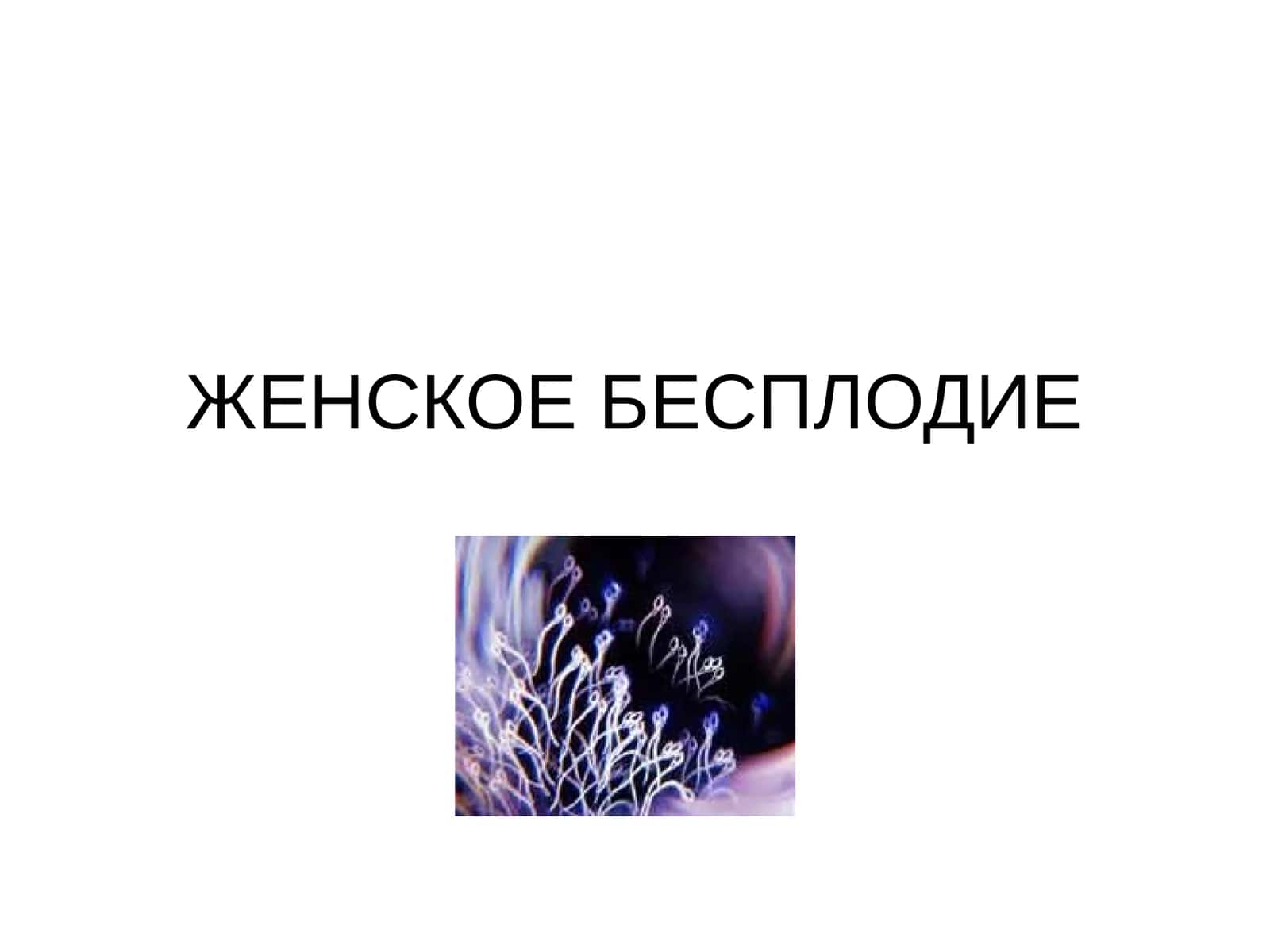 ЖЕНСКОЕ БЕСПЛОДИЕ