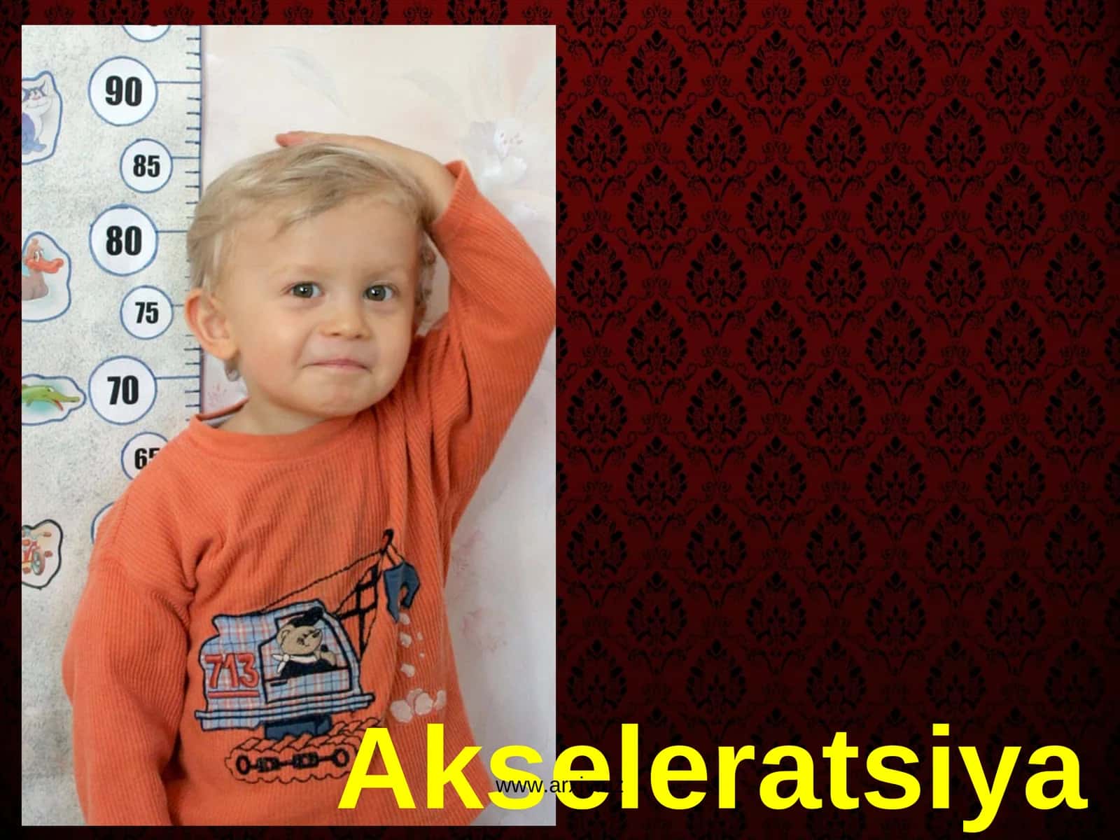 Akseleratsiya