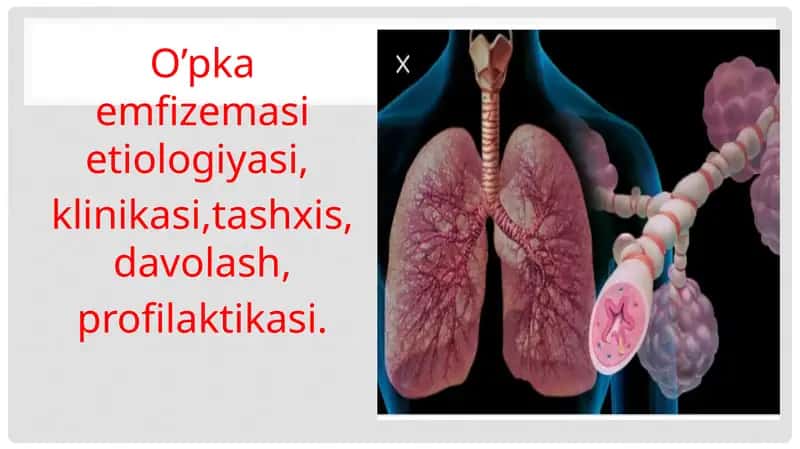 O’pkaemfizemasi etiologiyasi, klinikasi, tashxis, davolash, profilaktikasi