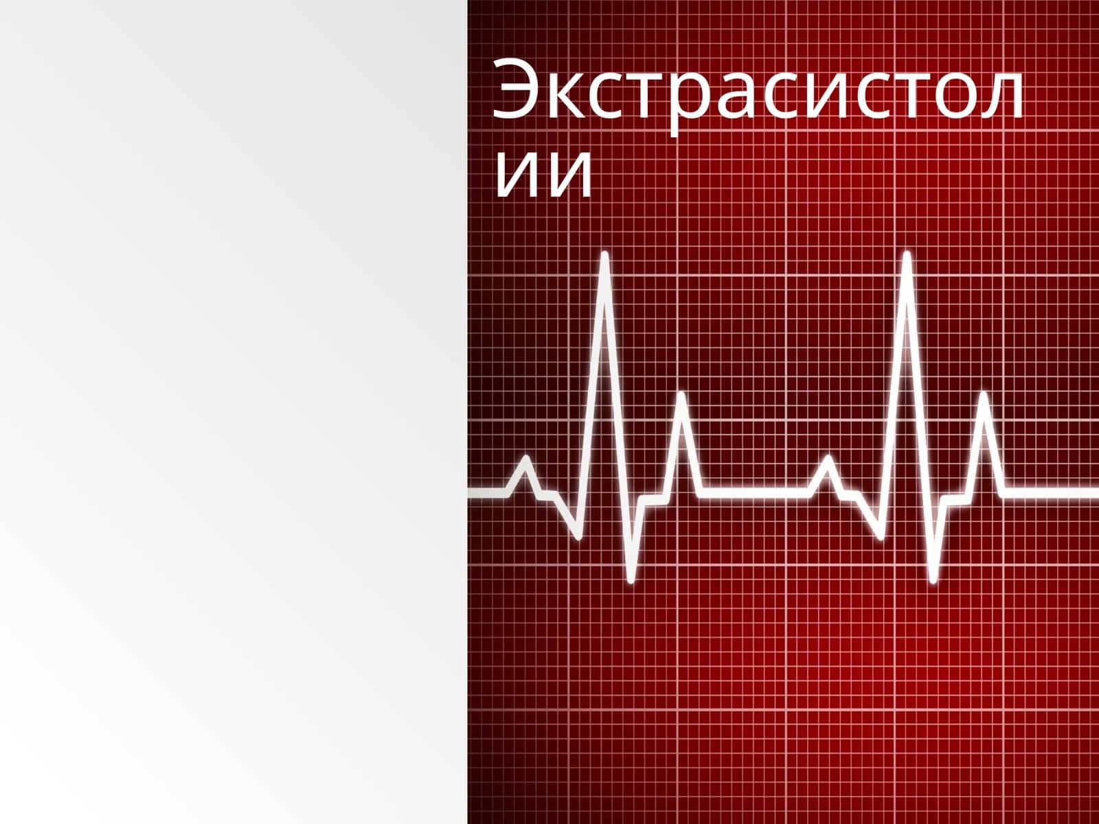 Экстрасистолия