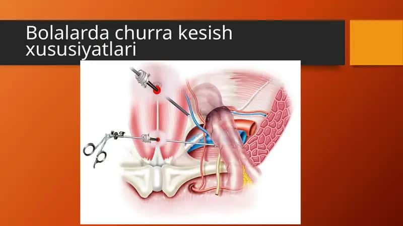 Bolalarda churra kesish xususiyatlari