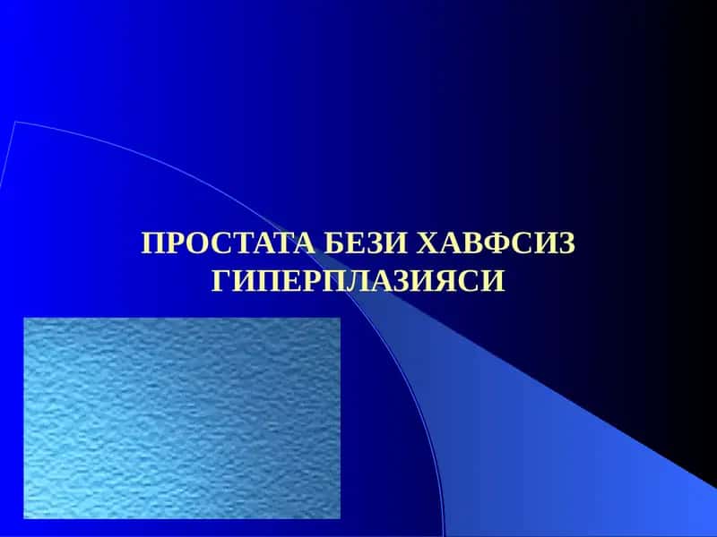 Простата бези хавфсиз гиперплазияси